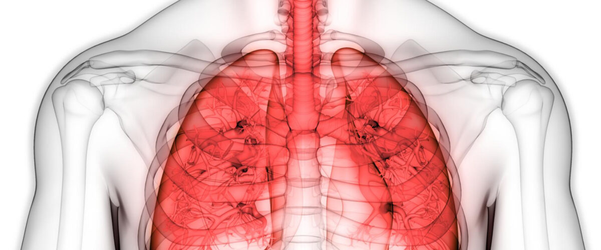 Mikronährstoffe bei Lungenkrebs